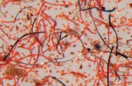 Red microfibers can be seen under a microscope.