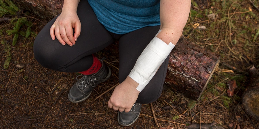 a hiker with a bandaged burn