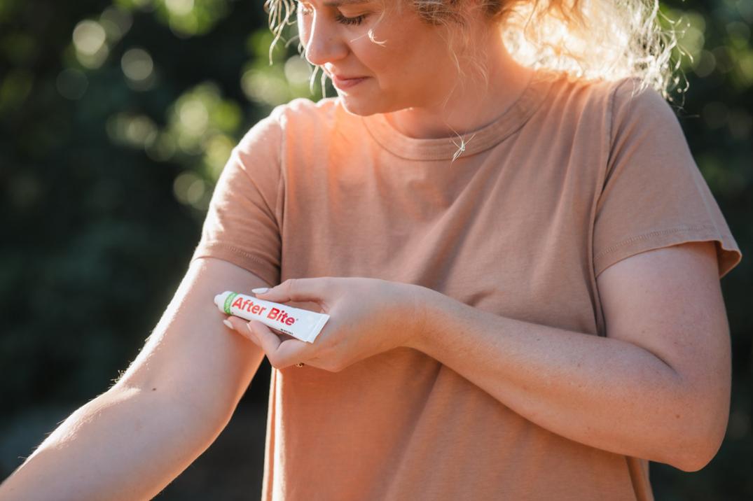 Location Image for Outdoor Insect Bite Treatment